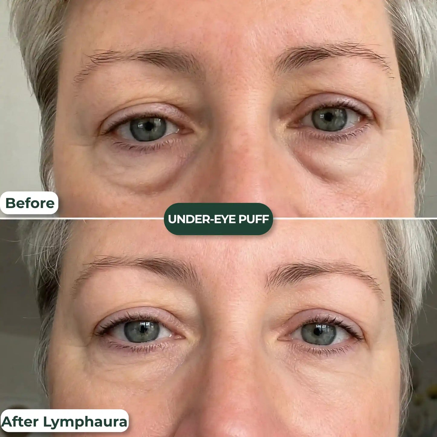 Lose the Puff & Feel Lighter in 7 Days