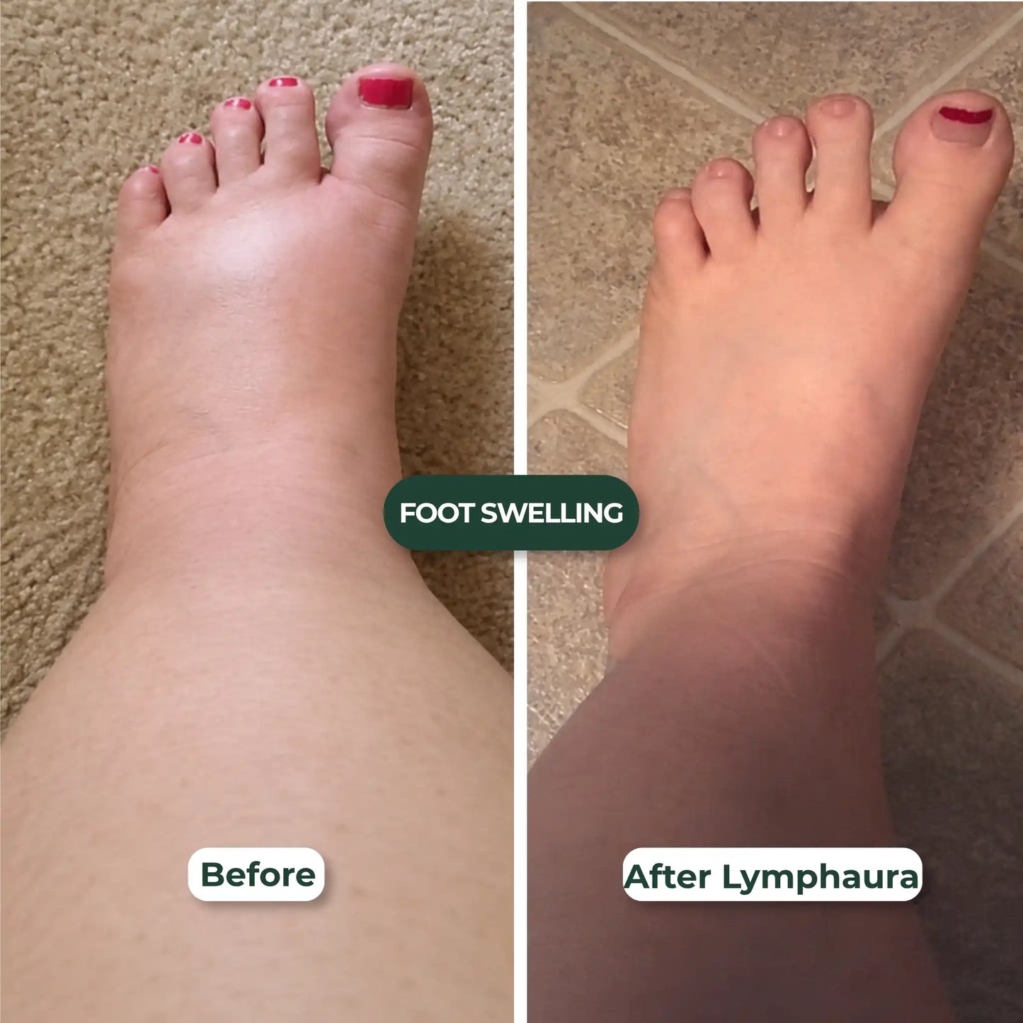 Lose the Puff & Feel Lighter in 7 Days